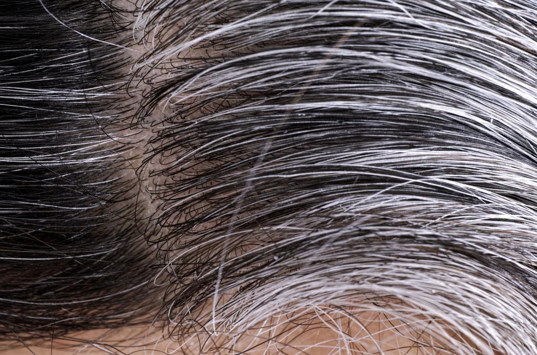 Try this easy method to keep you white hairs turned into black again